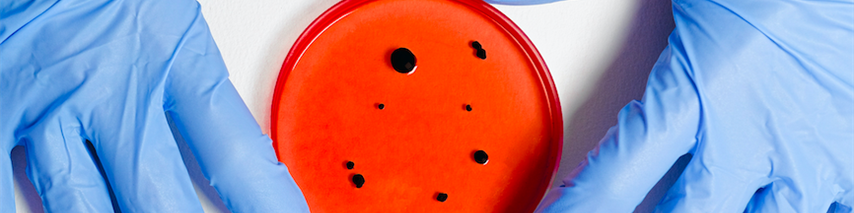 Scientist observing Coronavirus in a petri dish